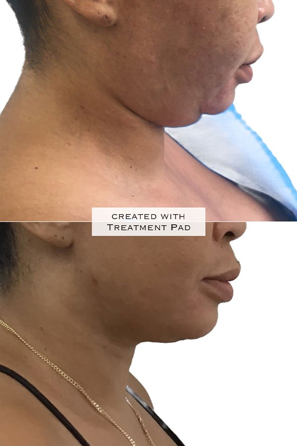 client