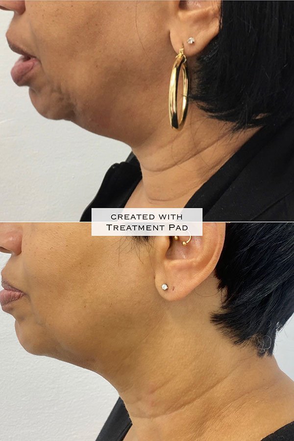 client